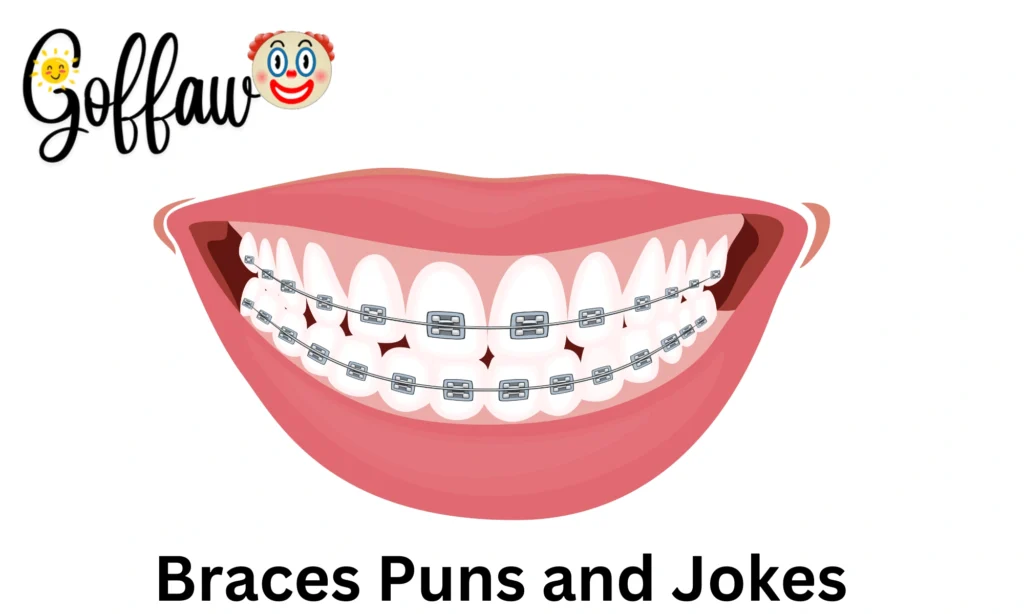 Braces Puns and Jokes